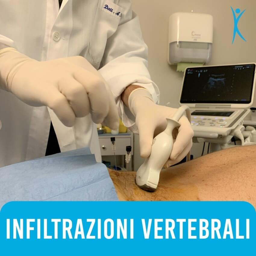 Lombalgia Acuta: Approcci Terapeutici e l’Efficacia del Metodo Infiltrativo