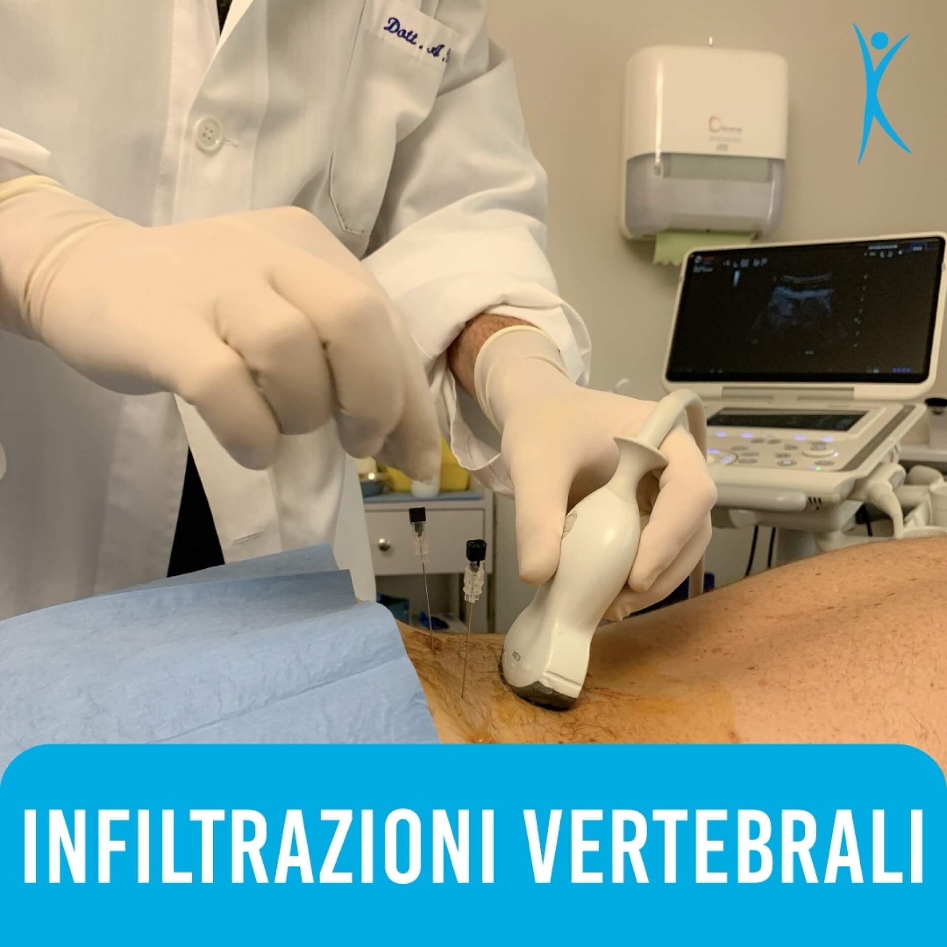 Lombalgia Acuta: Approcci Terapeutici e l’Efficacia del Metodo Infiltrativo
