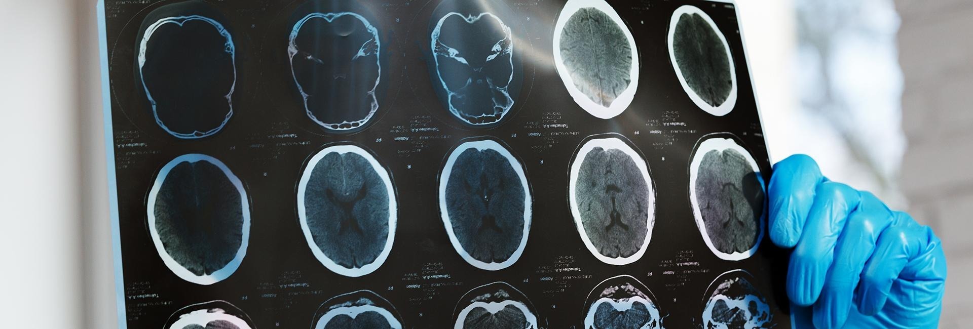 Visita Neurologica