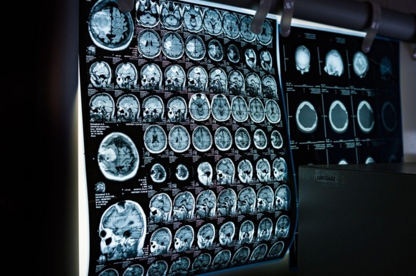 Visita Neurologica
