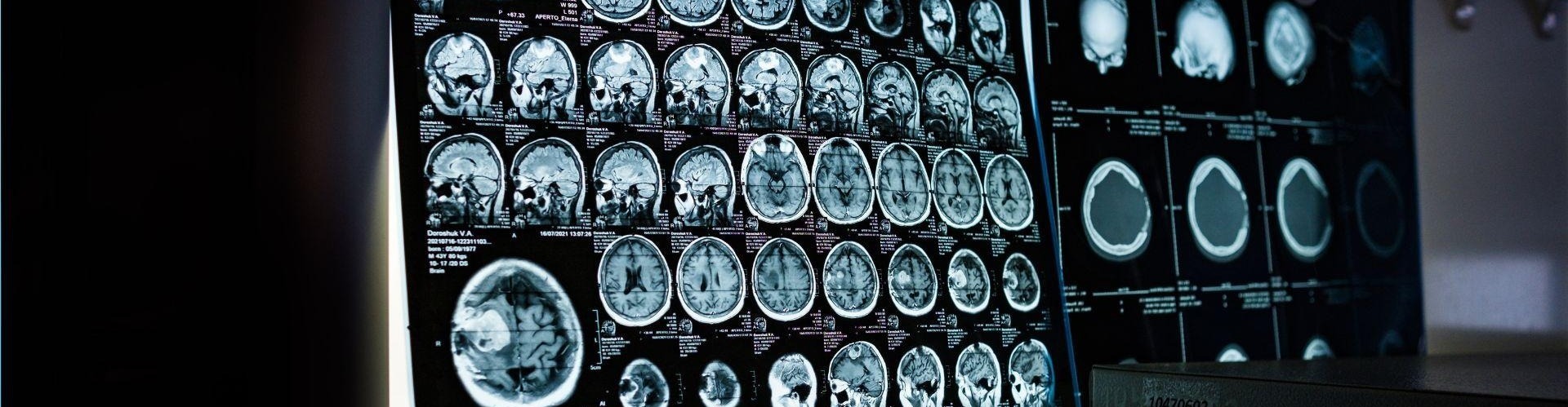 Visita Neurologica